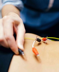 NW Calgary electrical Acupuncture